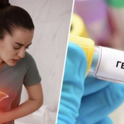 Hepatitis